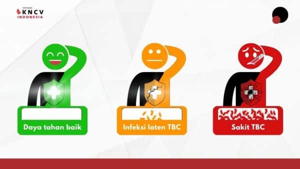 TBC